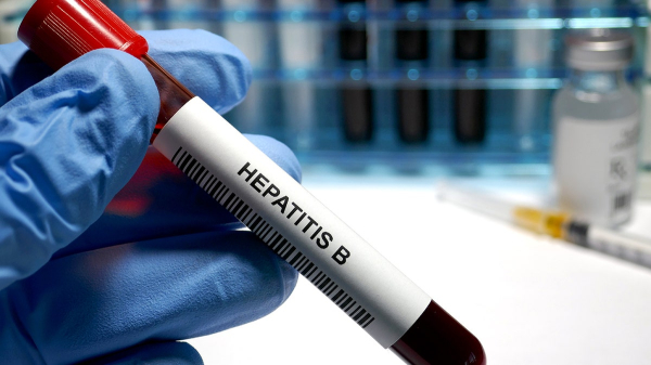 Hepatitis B in the spotlight: What to know about the viral infection Hepatitis B in the spotlight: What to know about the viral infection