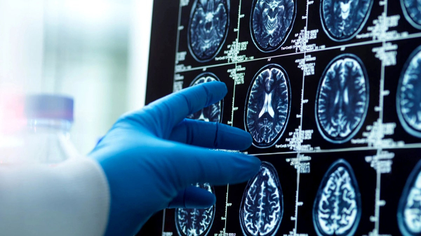 Scientists uncover how some 80-year-olds have the memory of 50-year-olds Scientists uncover how some 80-year-olds have the memory of 50-year-olds