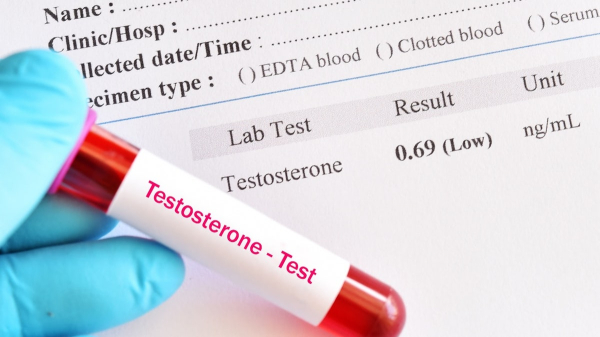 Low testosterone signs men can’t ignore — and what experts say about hormone therapy Low testosterone signs men can’t ignore — and what experts say about hormone therapy