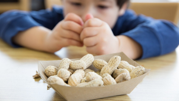 Common food allergy plummets nationwide after experts recommend bold new approach