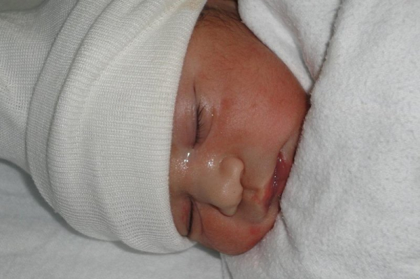 ByHeart recalls all infant formula amid botulism outbreak ByHeart recalls all infant formula amid botulism outbreak