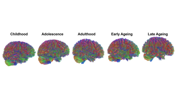 Your brain doesn’t age the way you think — new research upends old beliefs