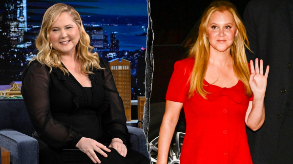 What to know about Cushing’s syndrome, which led to Amy Schumer's dramatic weight loss What to know about Cushing’s syndrome, which led to Amy Schumer's dramatic weight loss