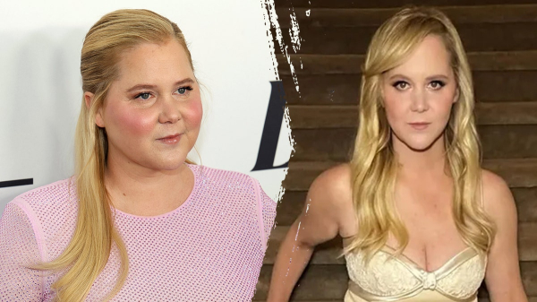 What to know about Cushing’s syndrome, which led to Amy Schumer's dramatic weight loss What to know about Cushing’s syndrome, which led to Amy Schumer's dramatic weight loss