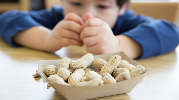 Early peanut exposure in babies tied to sharp drop in food allergy diagnoses