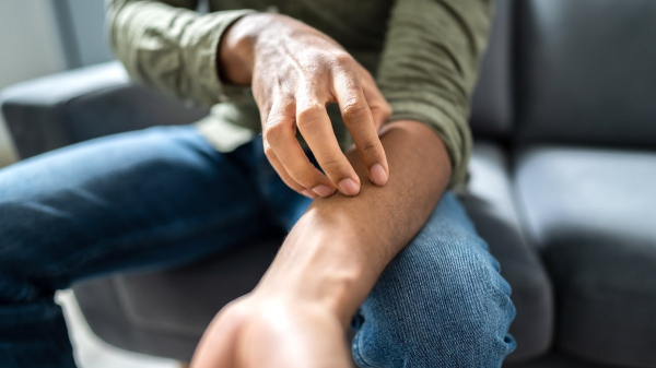 State confirms outbreak of sexually transmitted fungal infection, experts urge caution State confirms outbreak of sexually transmitted fungal infection, experts urge caution