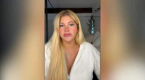Doctors warn of &lsquo;looksmaxxing&rsquo; dangers after influencer&rsquo;s livestream emergency