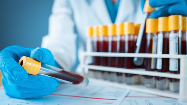 More patients demand &lsquo;unvaccinated&rsquo; blood, doctors warn of growing health risks