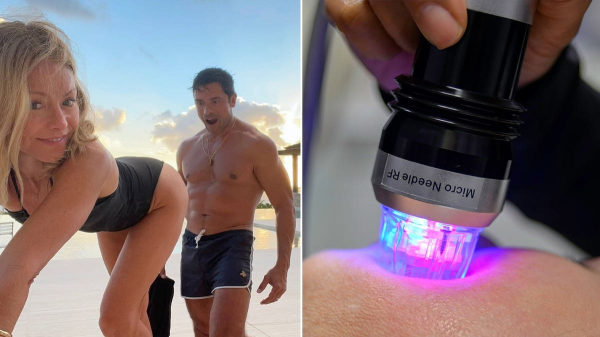 What is butt microneedling? Behind the 'desperate' procedure Kelly Ripa tried