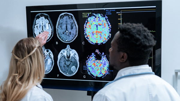 Simple body movement could help the brain 'clean itself,' researchers find