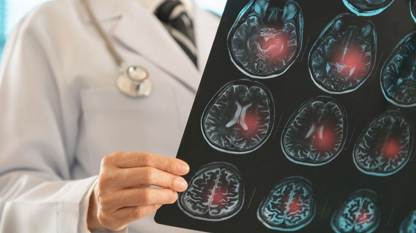 What to do if someone is having a stroke, after Jill Biden revealed debate-night fears