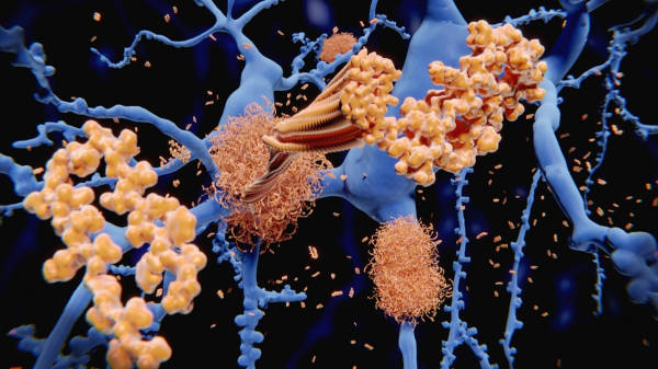 Alzheimer's blood tests may predict symptoms years in advance, but experts urge caution